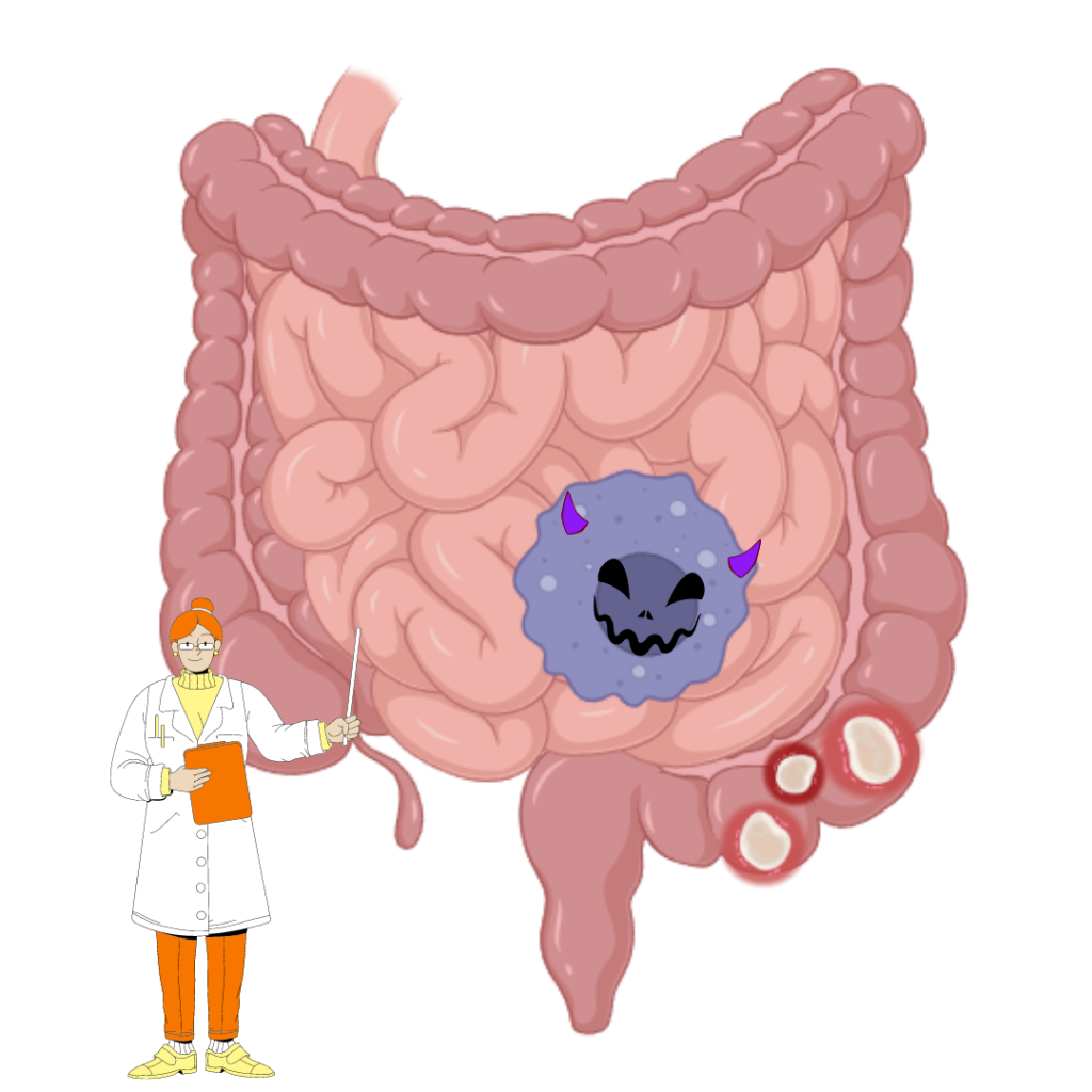 Cartoon Bri in a lab coats points toward anatomy cartoon of the intestines where a macrophage is adorned with devil horns and a scary face near the damaged part of the large intestine which is categorized by red inflamed circles.